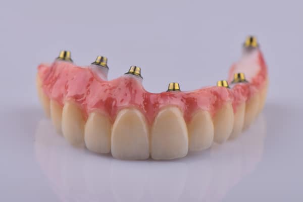 All in one zubni implanti